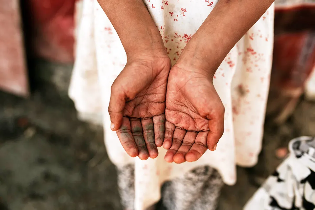 What Percentage of Your Donation Goes to the Work in the Field vs. Overhead Costs?